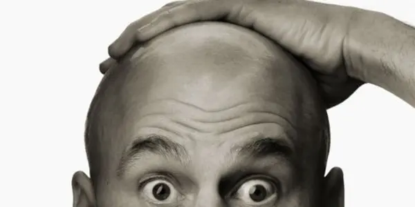 Quorum Sensing And Regeneration Response: Cure Baldness By Pulling Out Hair