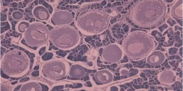 'Gender-Bending' Chemicals Like Estrogen In Rivers Are Impacting Reproduction