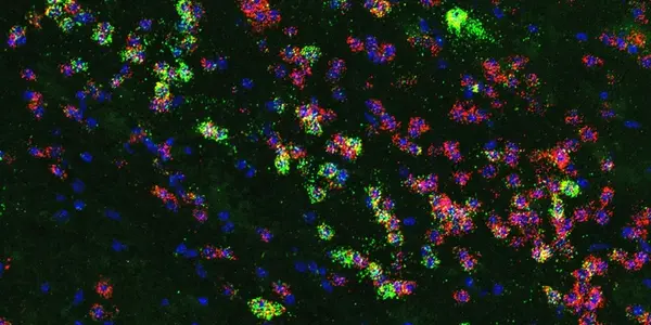Like Junk Food? Blame The Mouse Amygdala