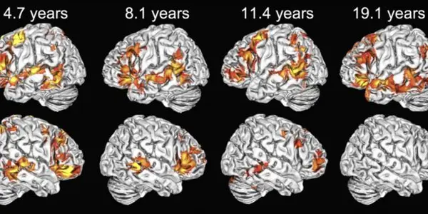 Children Use Both Brain Hemispheres To Understand Language, But Adults Don't