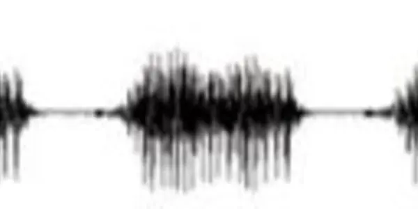 Left Inferior Frontal Sulcus Multitasks For Phonetics And Decision-Making