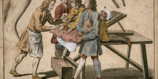 Lithotomy: A Painful Operation Inspired The 18th-Century Equivalent Of A Horror Movie Soundtrack
