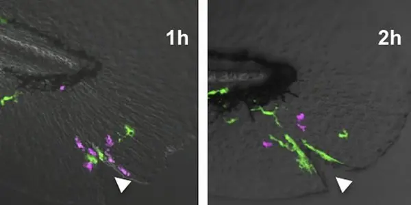 Macrophages Chase White Blood Cells Away From Wounds To Resolve Inflammation