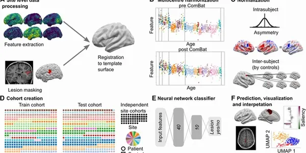 AI Algorithm Detects Brain Abnormalities - And May Help On The Road To Curing Epilepsy