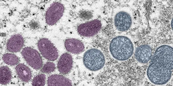WHO Extends Its Highest Emergency Level For...Monkeypox?