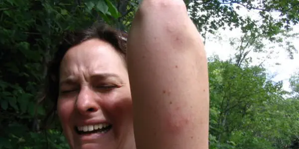 Think Mosquitoes Bite You More Than Other People? Here's Why You May Be Right