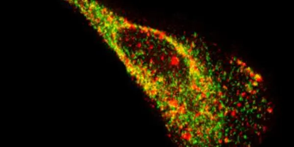 New Way To See Single RNA Molecules Inside Living Cells