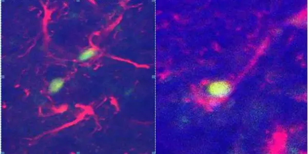 Embryonic Stem Cell Therapy Successful In Reversing Brain Birth Defects In Mice