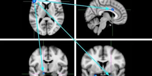 Meditation Gurus In Academia Should Stop Claiming Social Rejection Causes Violence And Meditation Prevents It