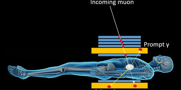 Imaging The Human Body With Muons