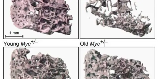 Myc Gene Activity Reduction Extends Healthy Lifespan In Mice