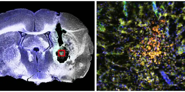 Neural Stem Cells Replace Stroke-Damaged Tissue In Rats