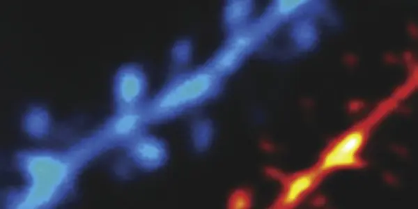 Fantastic Voyage Here We Come - Nanoscale Imaging Of The Living Brain