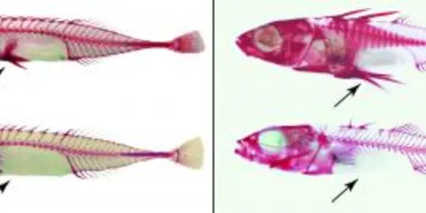 'Pelvis' Has Left The Building - Sticklebacks And Convergent Evolution