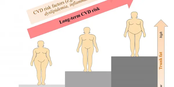 For Post-Menopausal Woman And Heart Disease Risk, Pear Is Better Than Apple