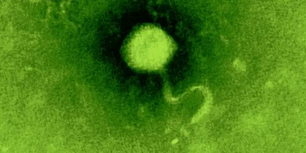 Antibiotic Resistance: Phages Can Transfer It In Chicken Meat