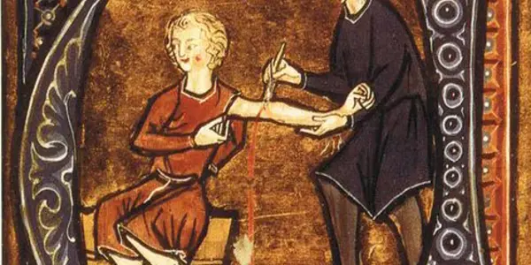 Astrological Bloodletting - Medieval Physicians Used Star Alignments For Phlebotomy Insight