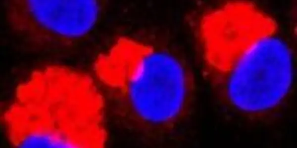 Natural Fatty Acid As A Potential Anti-Inflammatory