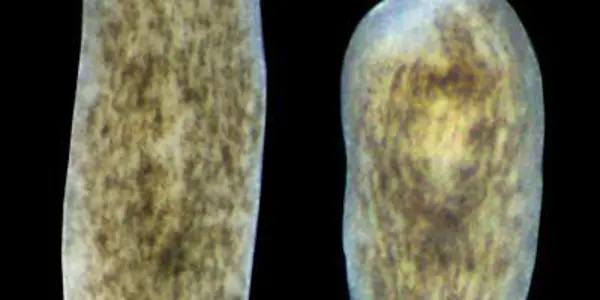 Gene Enables Stem Cells To Regenerate A Decapitated Head