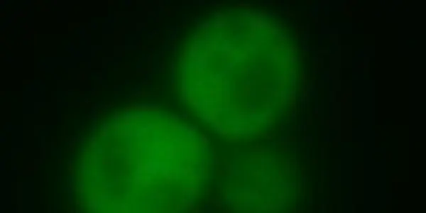 Yeast Cells Can Cure Themselves Of Prions Associated With Alzheimer's