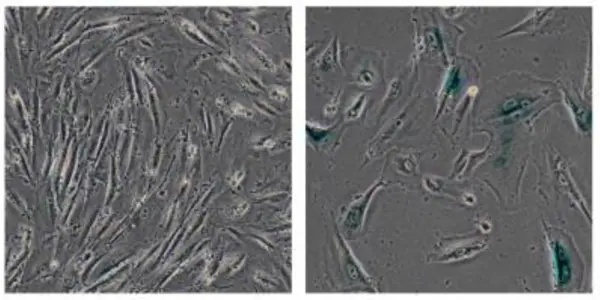 This Mutation May Be The Key Driver Of Human Aging