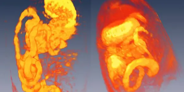 Can Numerical Modeling Match The Needs Of Science?