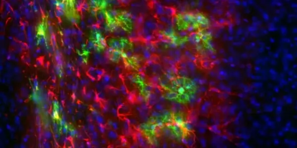 Can iPS Replace The Need for Embryonic Stem Cells?