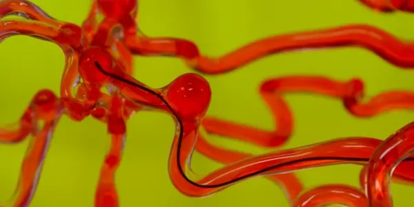 This Snake Crawls Through The Brain’s Blood Vessels - And That's A Good Thing