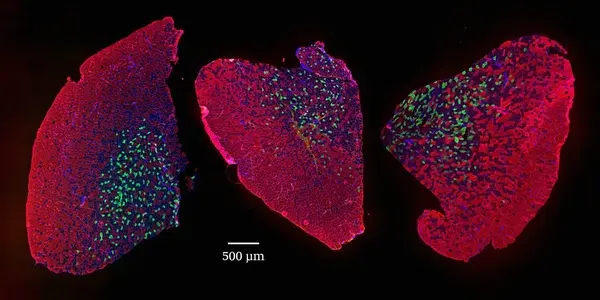 Rapamycin May Prevent Sarcopenia And Keep Muscles Stronger For Longer