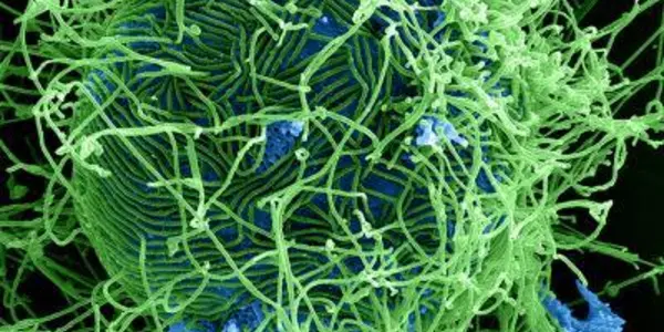 Ebola Outbreak Shows Global Disparities In Health Care