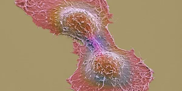 Live And Let-7: Autophagy And Cell Survival
