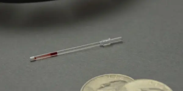 Sickle Cell Is Still A Killer But This 50 Cent Test Could Change That