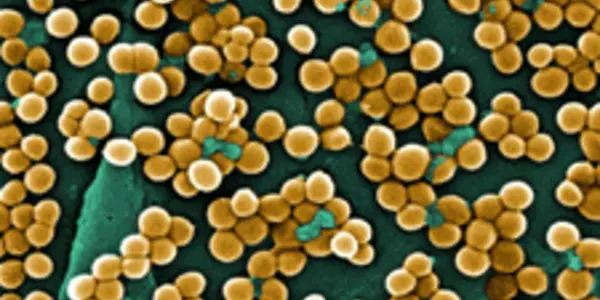 Resistant Staph Bacteria Has Met Its Match: Blue Light