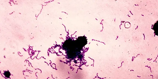 Thanksgiving Dinner Means A Bacterial War For Your Teeth