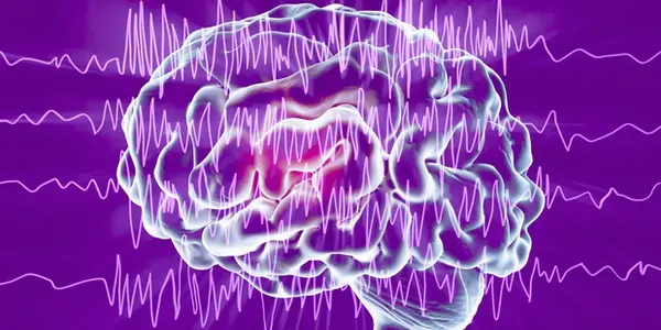 Can The Aidan Tree Be An Epilepsy Treatment?