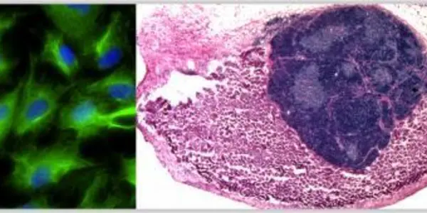 Replacement Organs: Scientists Grow Thymus In Living Animal From Laboratory Cells