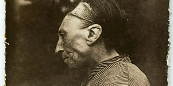 10,000 Years of Artificial Cranial Modification