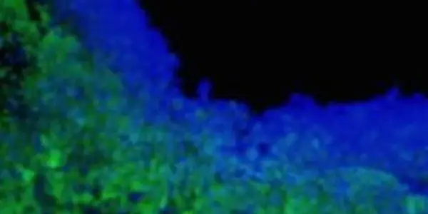 Genetically Modified Stem Cells Kill Brain Tumors