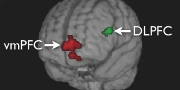 The Neuroscience Benefits Of Lent