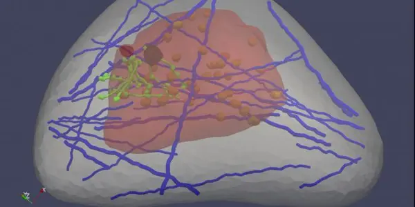 Ultrasound Elastography: 'Virtual Breast' Could Improve Cancer Detection