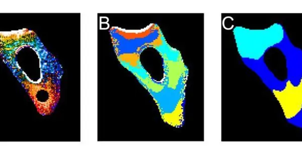 How Unfolded Proteins Move In The Cell - Visualized