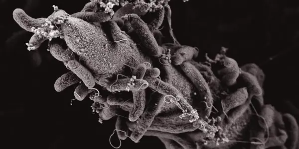 Cholera Bacterium Is The Mad Max Of DNA