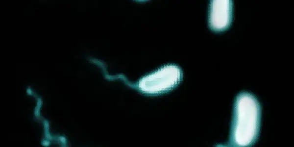 Iron Overload Disease Causes Rapid Growth Of Deadly Vibrio Vulnificus Bacteria