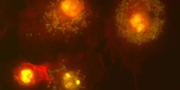 Extra Genes Make Bacteria Lethal