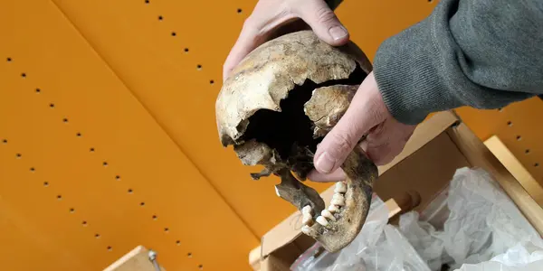 Mercury As Medicine, Toxic Lead, Syphilis - Being Rich In Ancient Times Was The Kiss Of Death