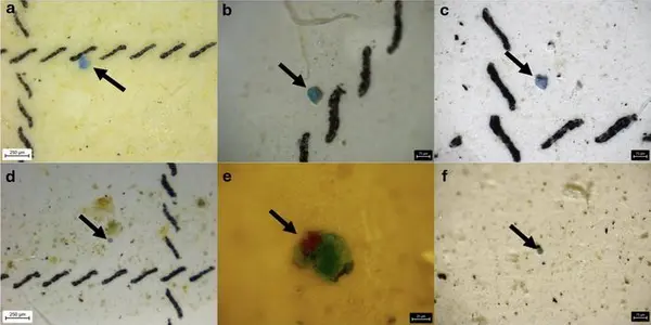 Epidemiology: Microplastics Cause Lung Cancer