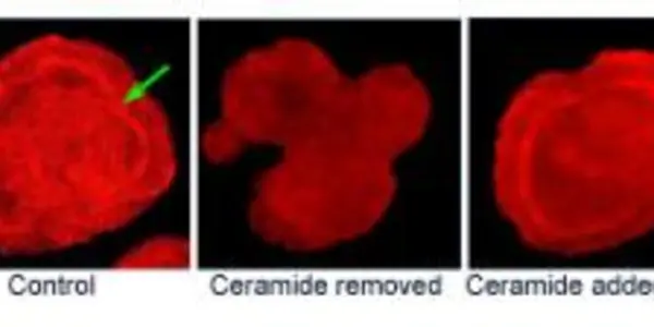 Lipid Plays Big Role In Embryonic Development