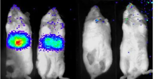 TORC2 And SIK2 Next Targets For Type II Diabetes