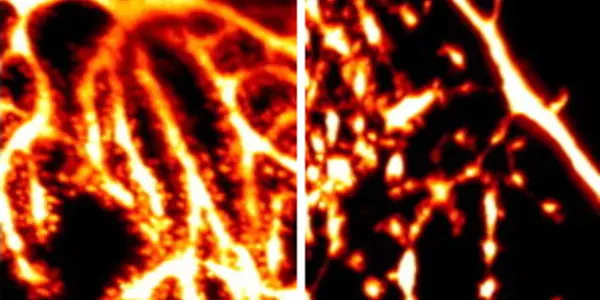 Scientists Show Brain Cells Need microRNA to Survive