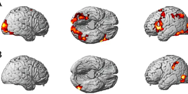 Identified: Locations Of Thought Processes For Familiar Objects
